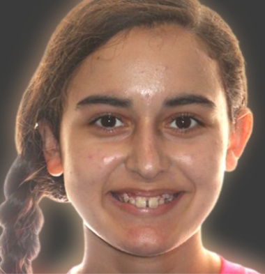 Teens patient 1 smile before orthodontic treatment
