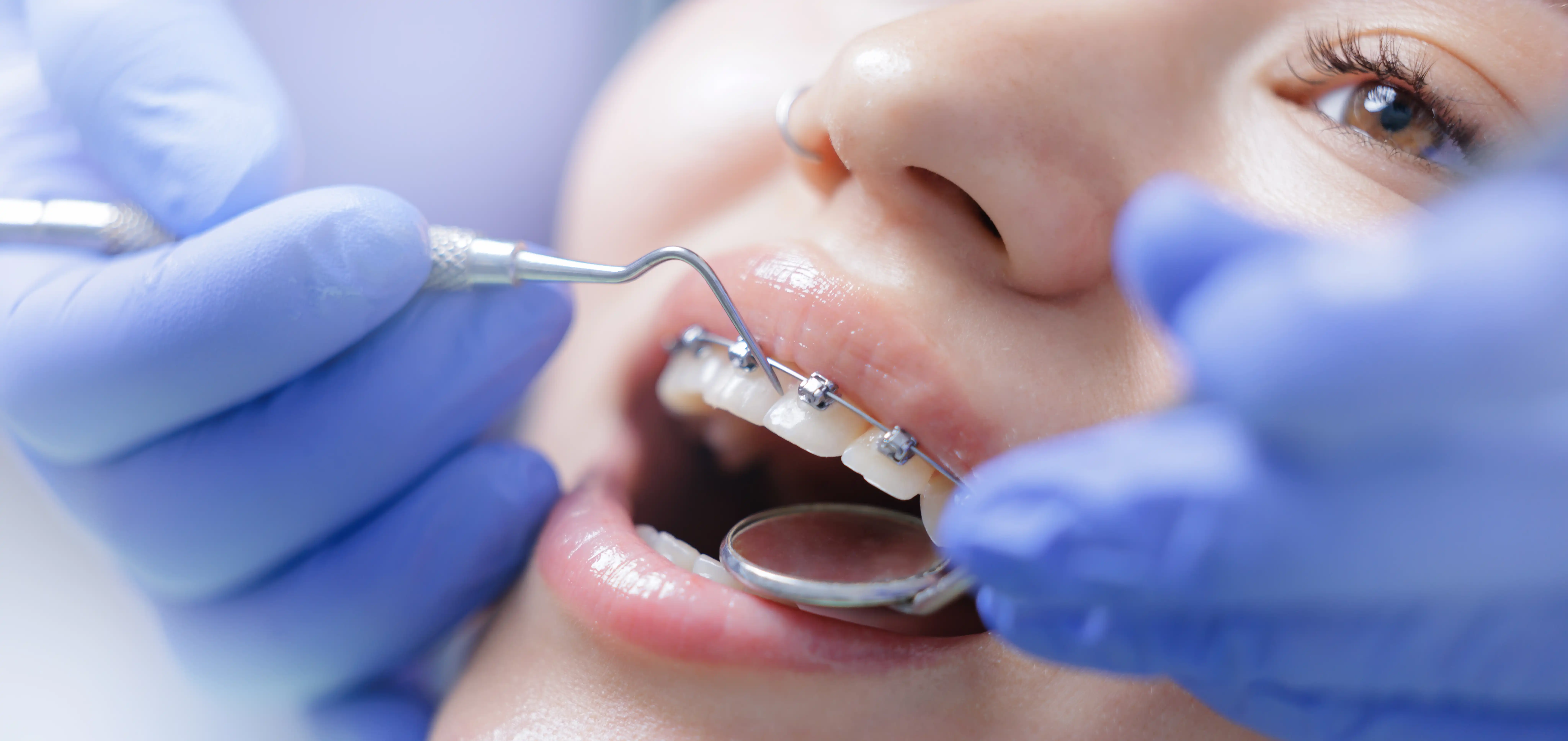 Happy dental patient