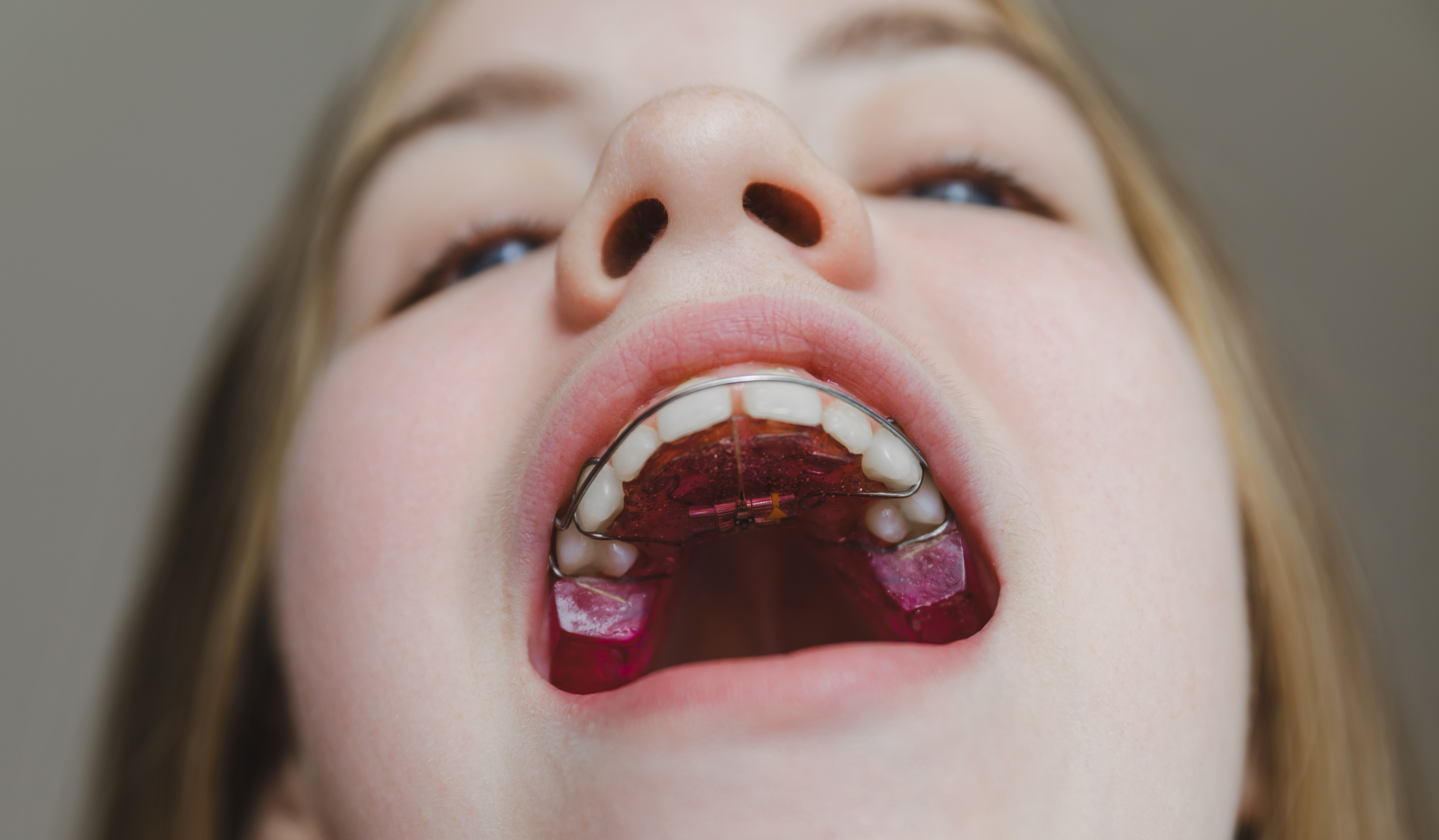 Orthodontics for Adults Treatment Background