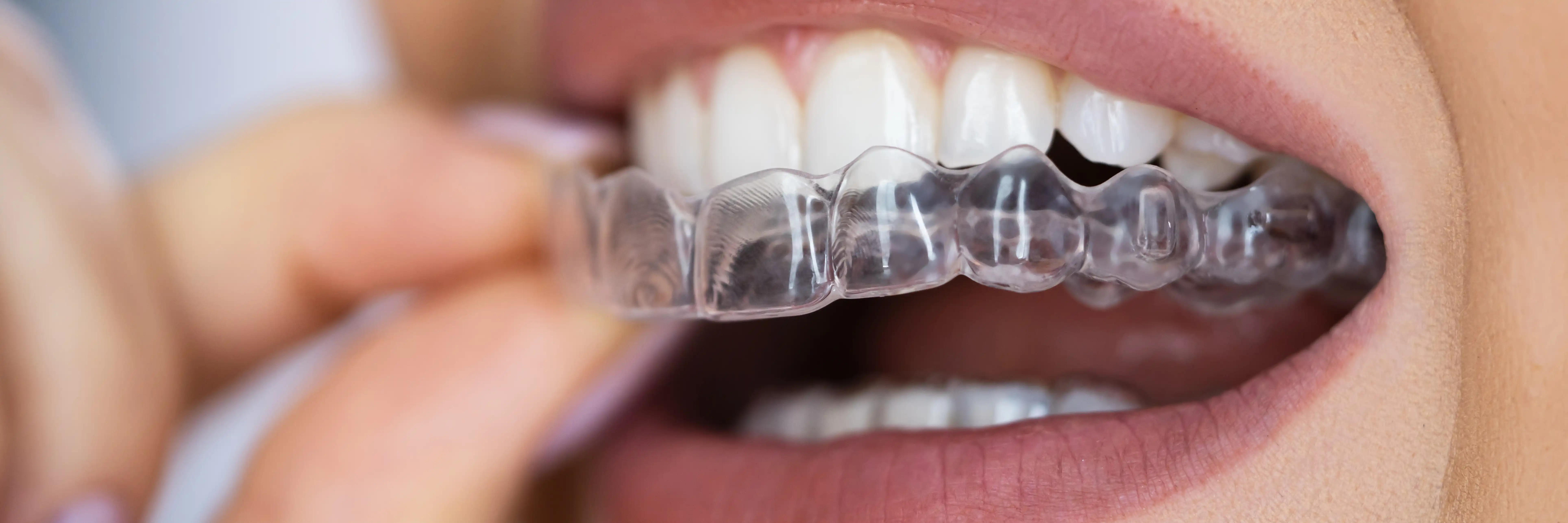 About Dental Care Orthodontics in Stamford, CT
