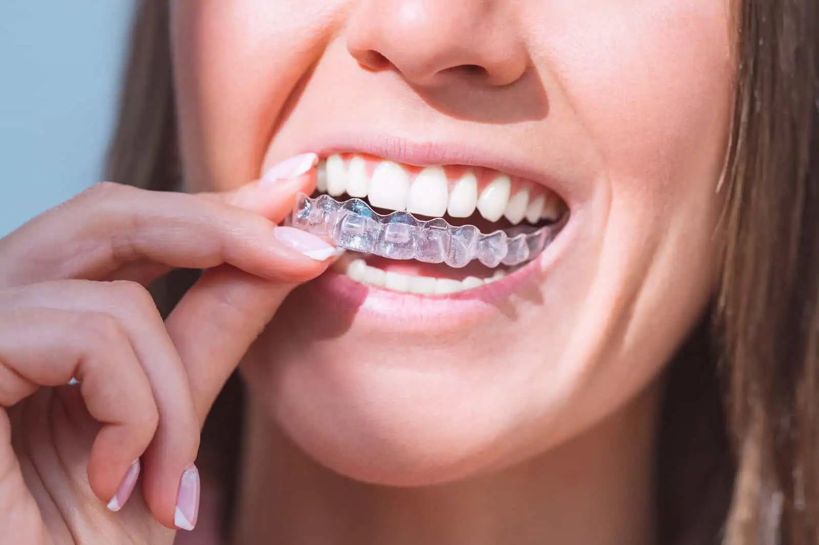 Orthodontics tailored for kids, teens, and adults